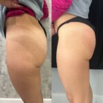 delrayderm_355875928_810605217012720_4965895316398877921_n