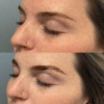 delrayderm_366831046_18294750457190141_765317016525266492_n