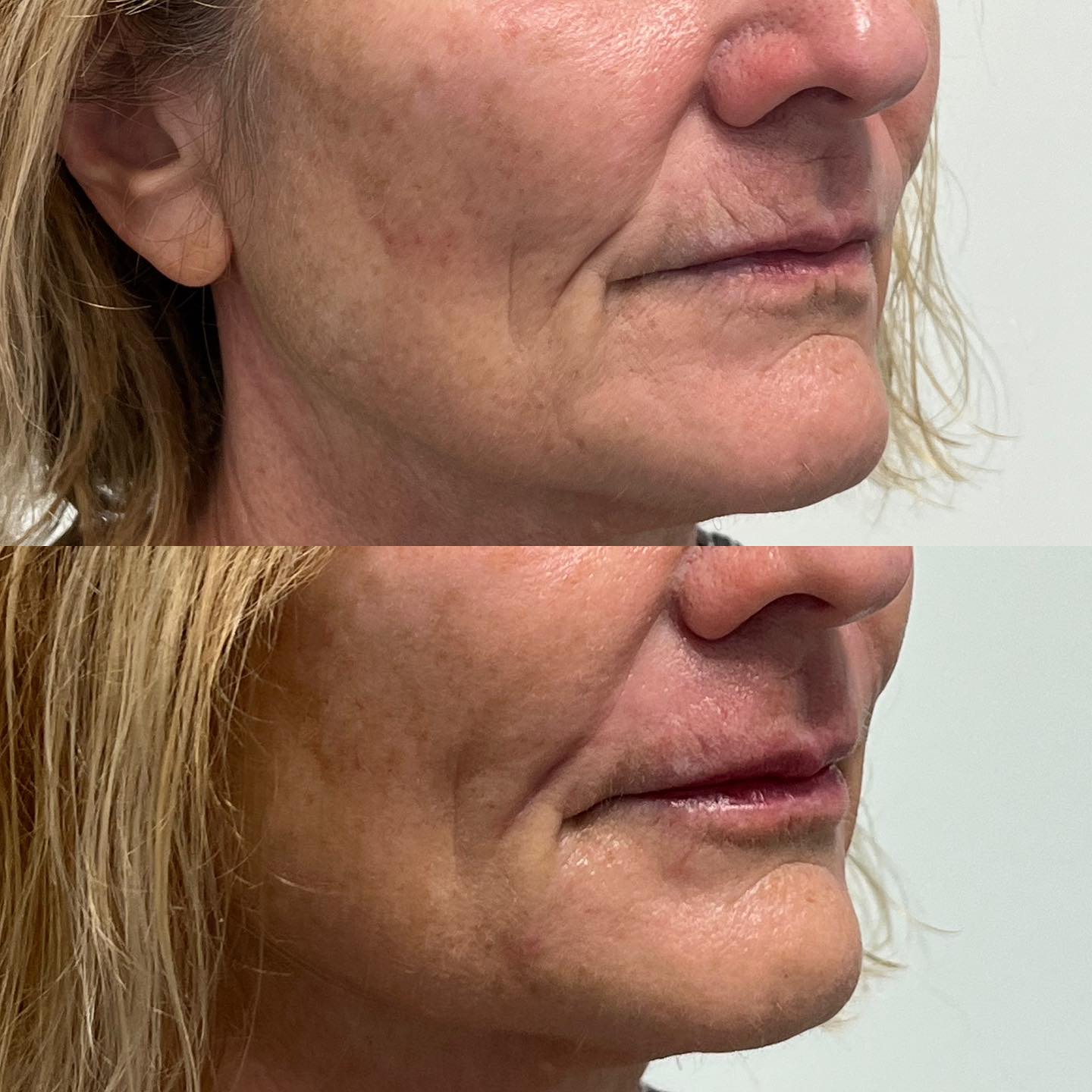 delrayderm_370570381_18296940148190141_2760961673870198923_n