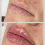 rachel_injects_364312351_1349051889322386_3274111174991944166_n