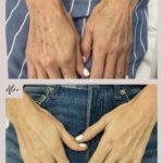 rachel_injects_366466481_336684798688293_205676921798952941_n