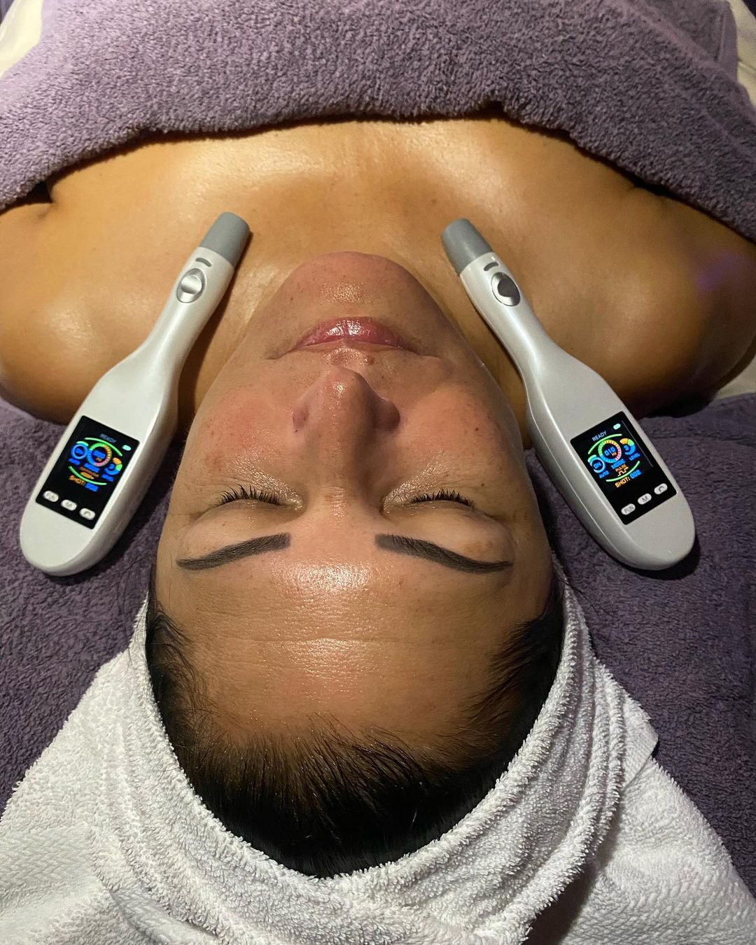 skinapeelspa_364275997_784820243356512_1567027081479810782_n