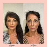 themelglow_364054675_211077548596559_5194737768600209073_n